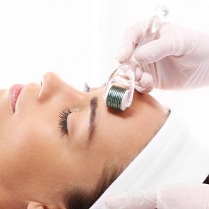 WOW Fusion Needling