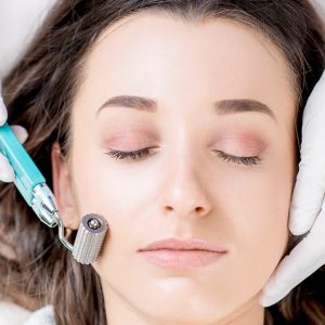 Skin Needling