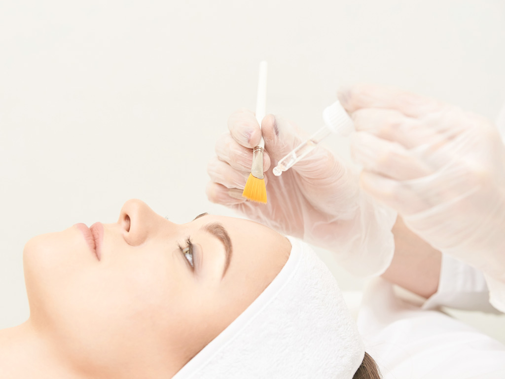 Facial Peels